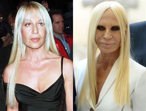 donatella versace jeune 1997|donatella versace before and after.